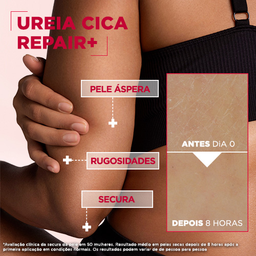 Urea Cica repair